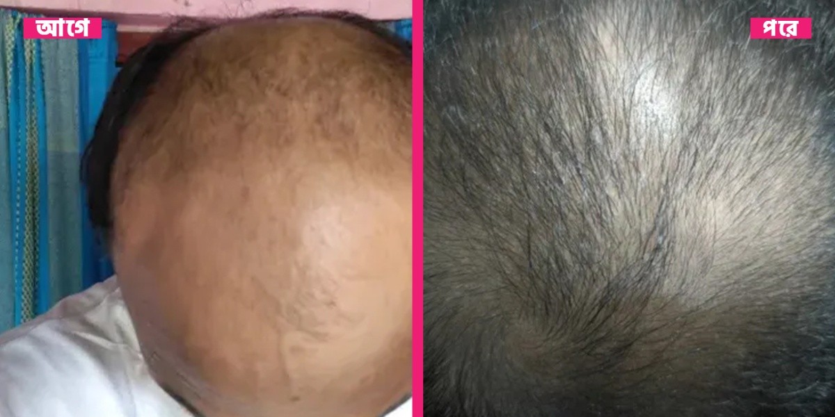 96f454d9-fe19-4e38-bc14-9f5660fa1bfe (1)